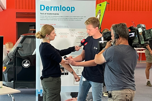 TV2-journalist bliver live testet for modermærkekræft af læge og forsker Niels Kvorning Terlov via kunstig intelligens-teknologien Dermloop på Herlev Hospital